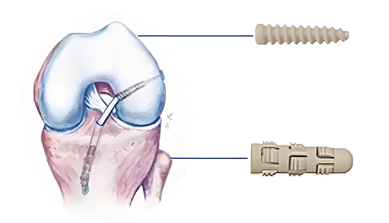 1724039795393061.jpg 1724039795393061.jpg